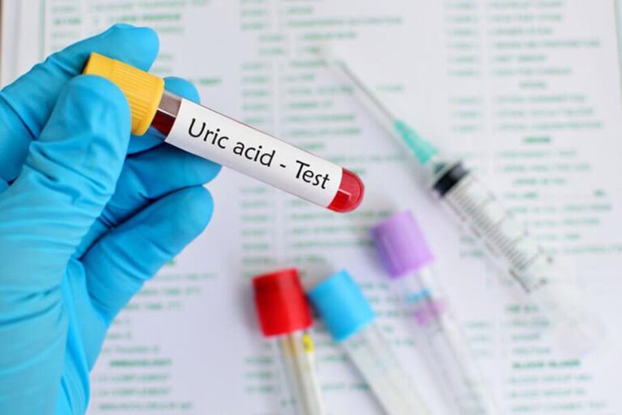 cách đào thải acid uric nhanh