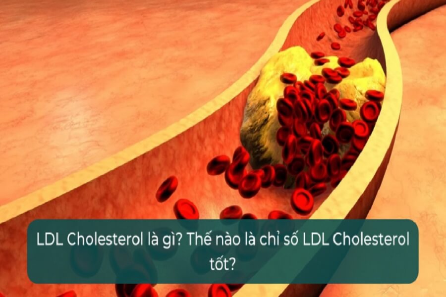 ldl cholesterol là gì