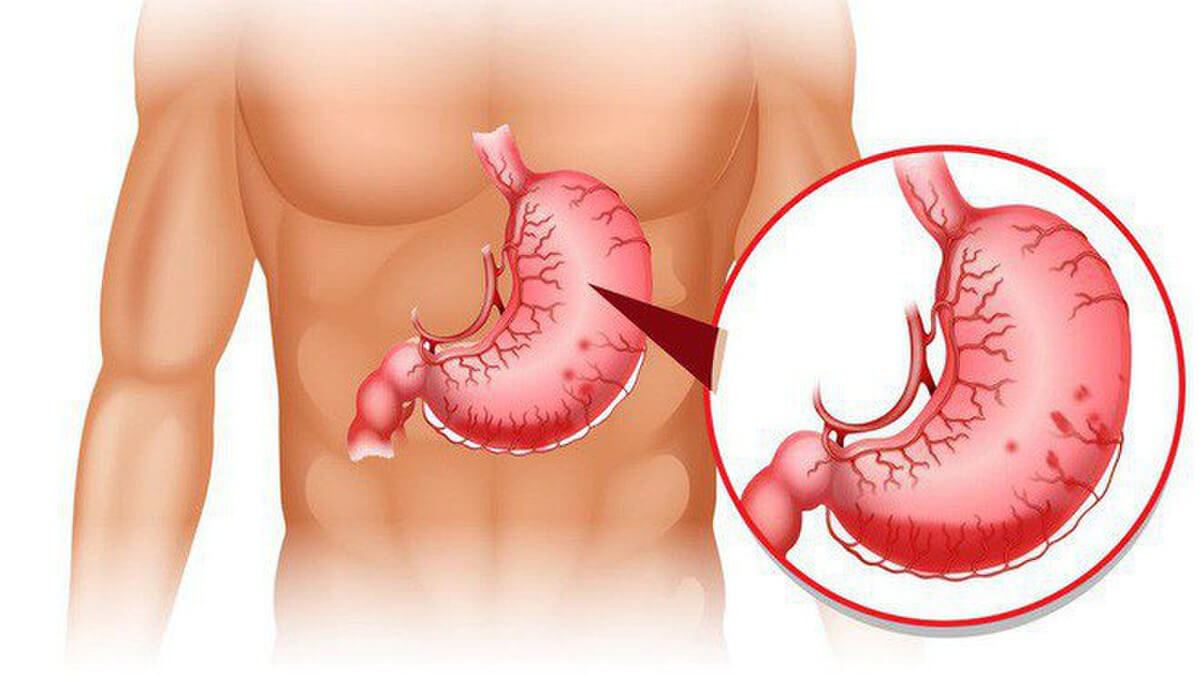 Chức năng chính của dạ dày là Dự trữ - nghiền và phân hủy thức ăn.