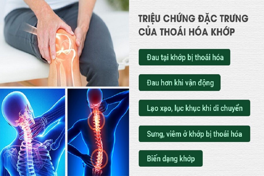 triệu chứng thoái hóa khớp gối