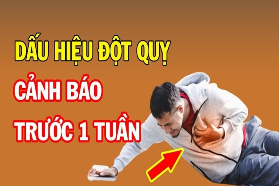 dấu hiệu đột quỵ trước 1 tuần