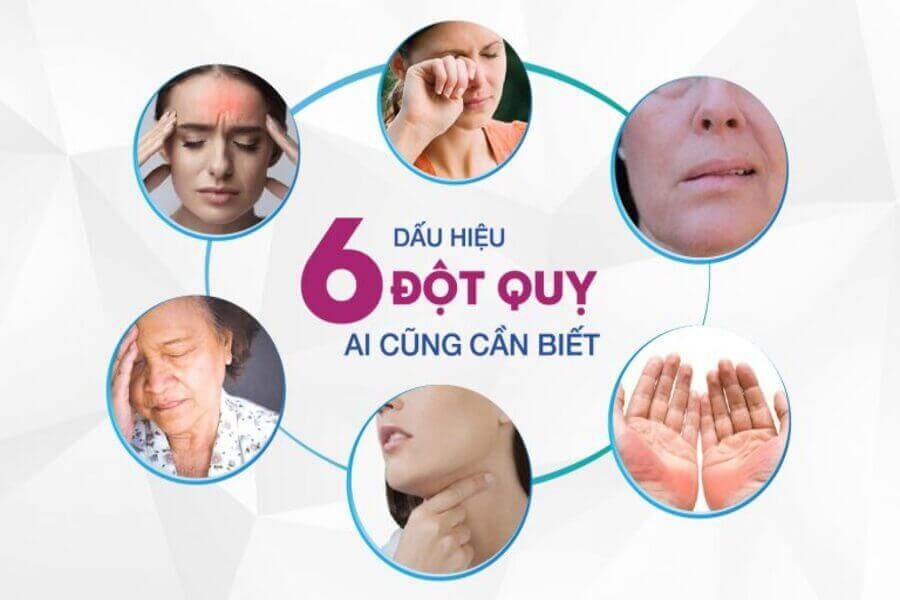 dấu hiệu đột quỵ