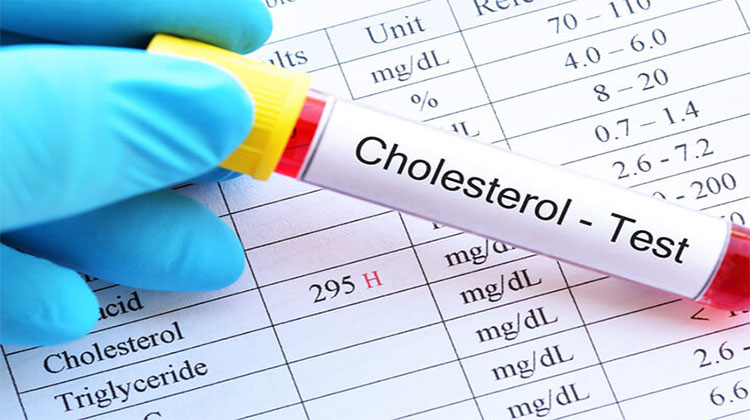 định lượng cholesterol toàn phần