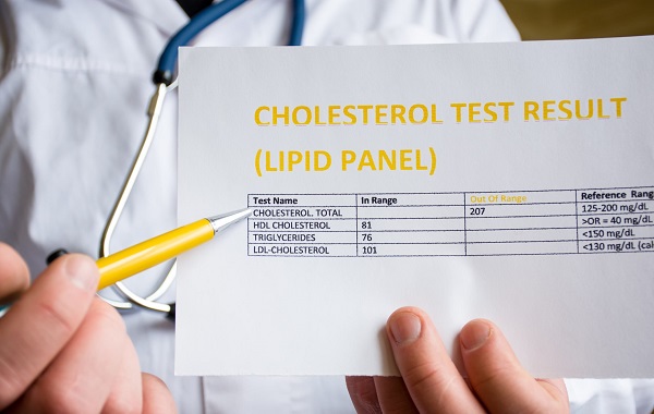 dinh luong cholesterol toan phan la gi doi voi suc khoe