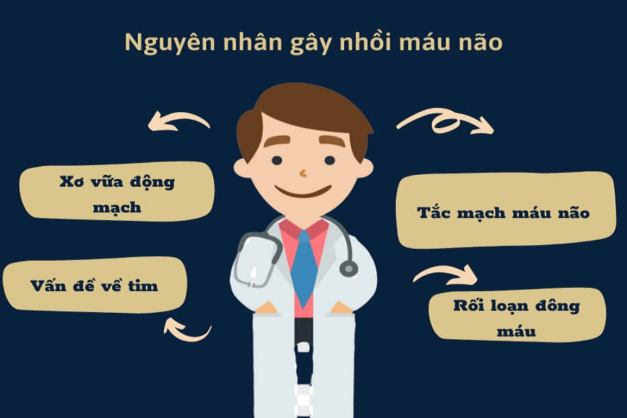 Nhồi máu não