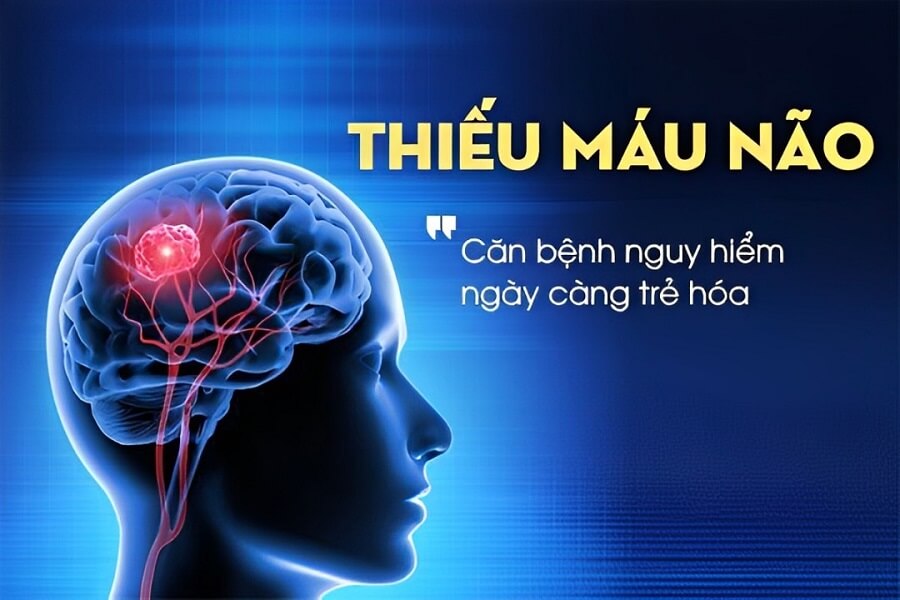 triệu chứng thiếu máu não