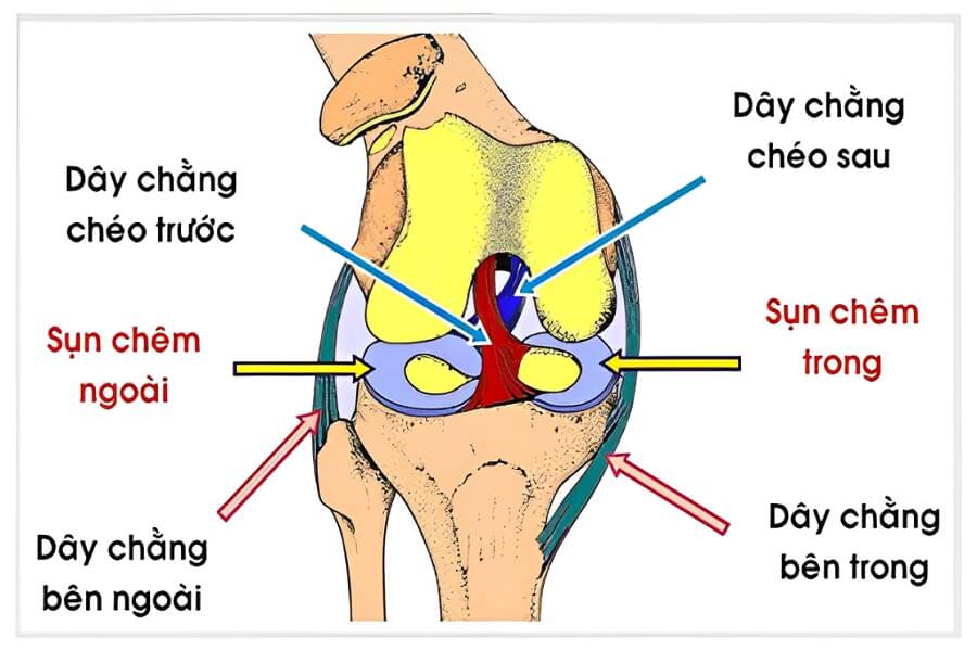 Đứt dây chằng chéo sau