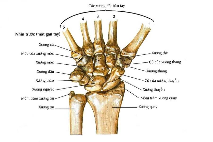 trật khớp cổ tay