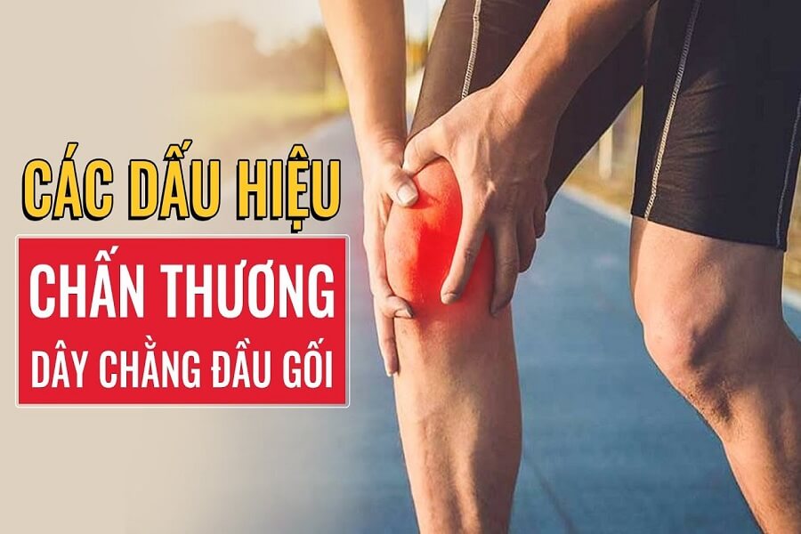 dấu hiệu đứt dây chằng gối