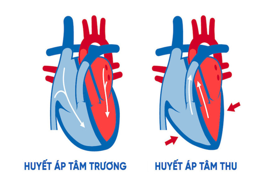 huyết áp tâm trương cao