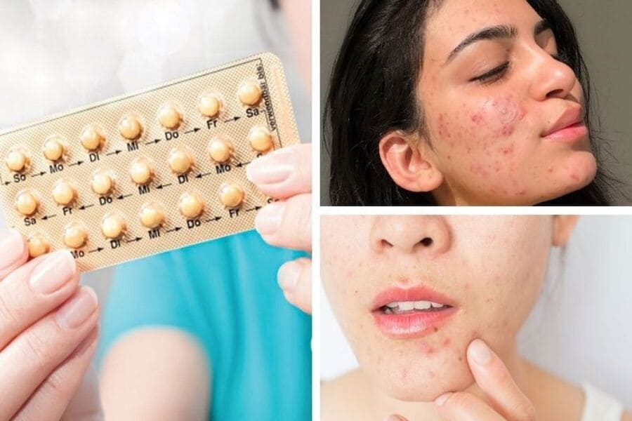 uống thuốc tránh thai hàng ngày có hại không