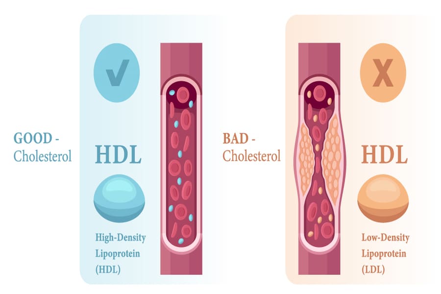 hdl và ldl là gì