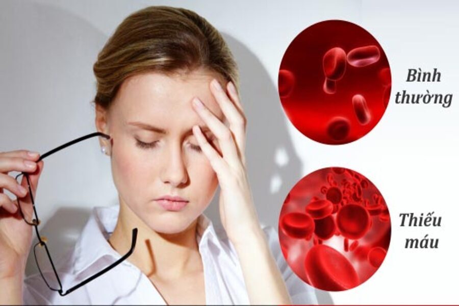 dấu hiệu thiếu máu