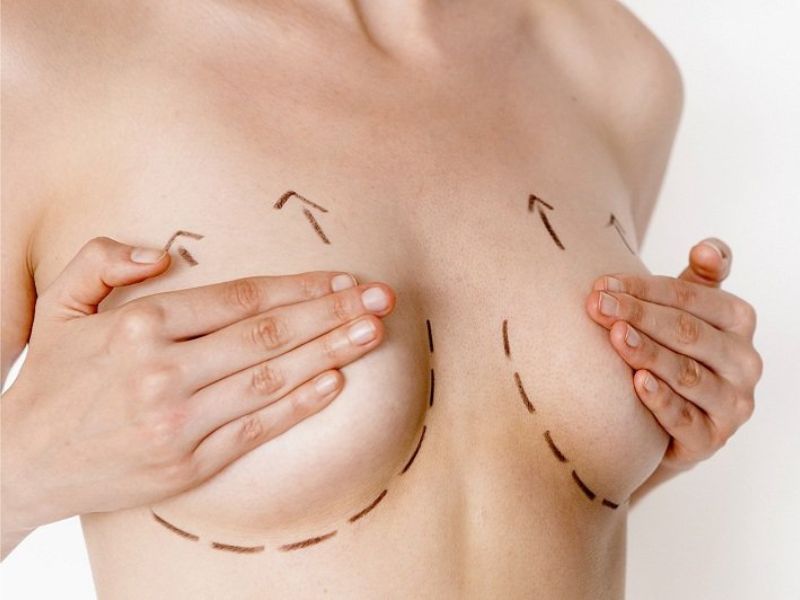 phương pháp tăng vòng 1