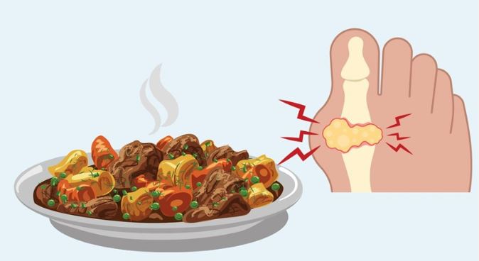 chế độ ăn uống bệnh gout