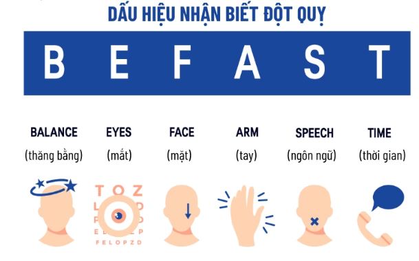những dấu hiệu đột quỵ
