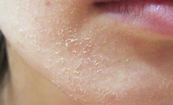 những dấu hiệu thiếu chất