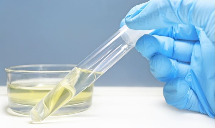 những dấu hiệu thiếu nước