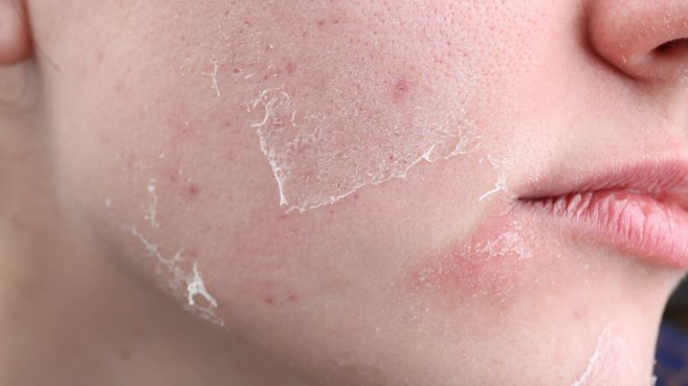 những dấu hiệu thiếu omega 3