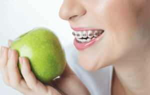 chế độ ăn uống khi niềng răng